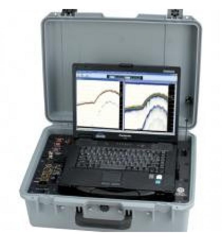 Echotrac CVM